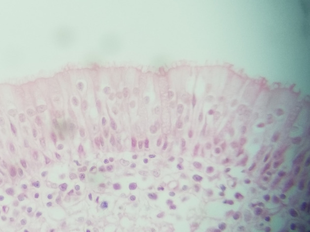Pseudostratified Epithelium Slides - Pseudostratified Epithelium 06 400X